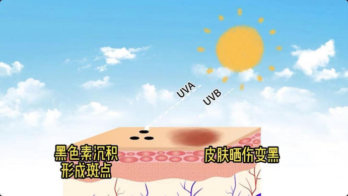 艾詩(shī)特蝦青素
