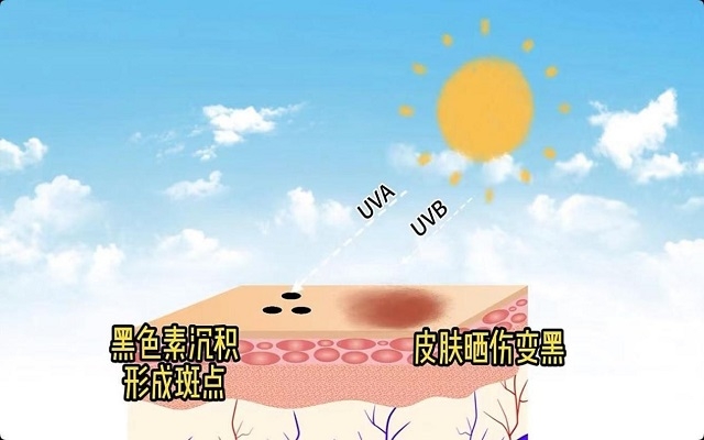 天然蝦青素可以祛斑嗎？